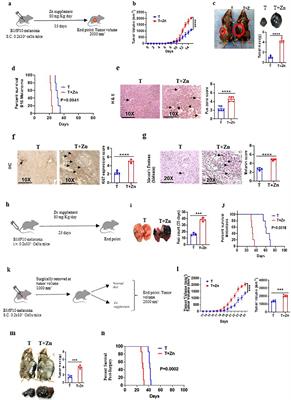 Zinc dampens antitumor immunity by promoting Foxp3+ regulatory T cells
